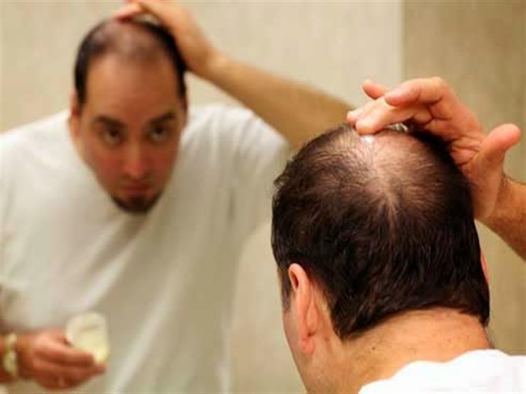 العلاقة بين الغدة الدرقية وتساقط الشعر