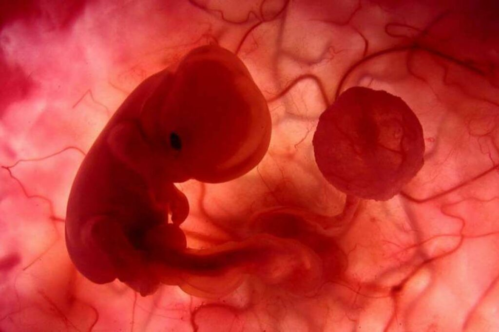 لون دم الإجهاض في الأسبوع الأول | ويكي علم