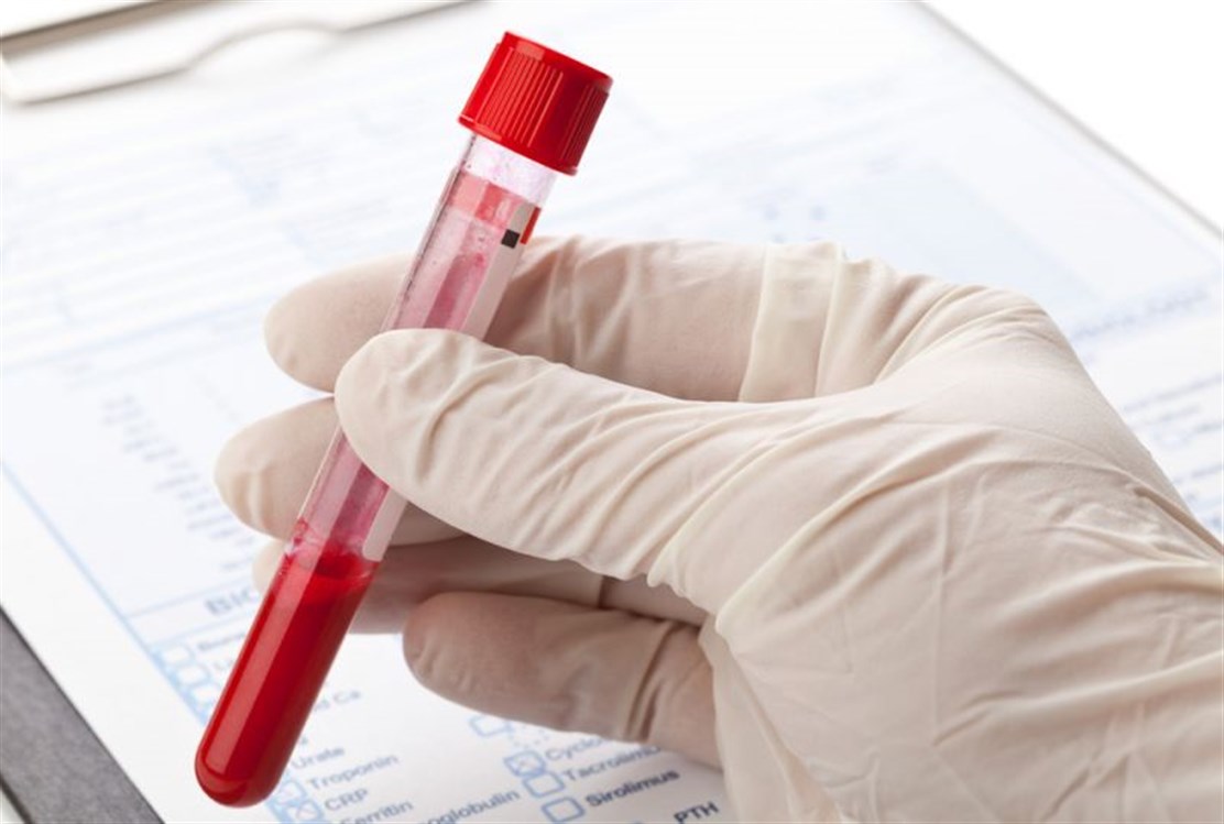 اختبارات لكشف سرطان الدم