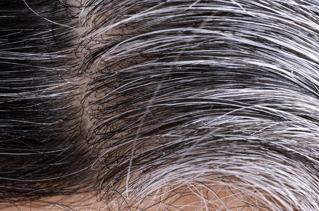 علاج ظهور الشعر الابيض في سن الثلاثين